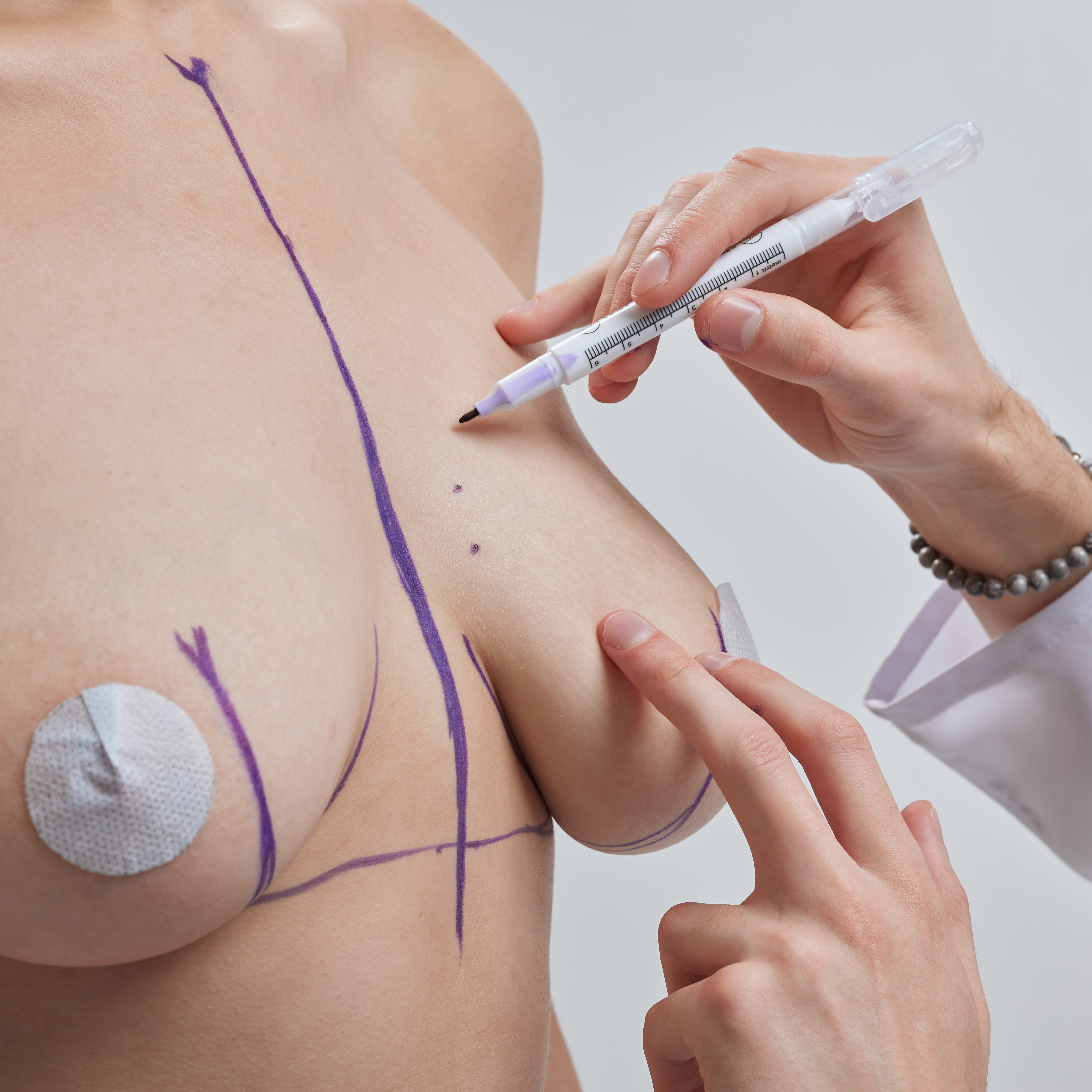 Breast Lift Surgery