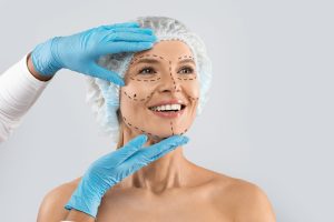 Chirurgie du lifting facial (2)